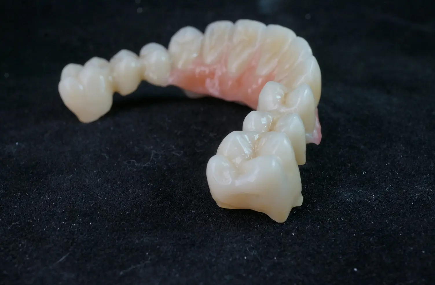 Imagen de Layered Cutback Zirconia Crowns