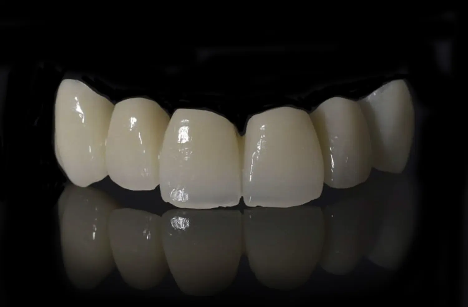 Imagen de Multilayer Zirconia Crowns